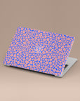Puffy Spring MacBook Case