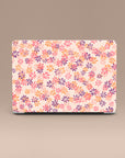 Ditsy Summer MacBook Case