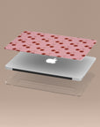 Cherry Bliss MacBook Case
