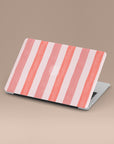 Coral Stripe MacBook Case