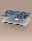 Blue Zebra MacBook Case