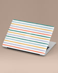 Summer Stripes MacBook Case